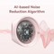 Vention Elf E06 Earbuds NBKW0 White - фото 76705